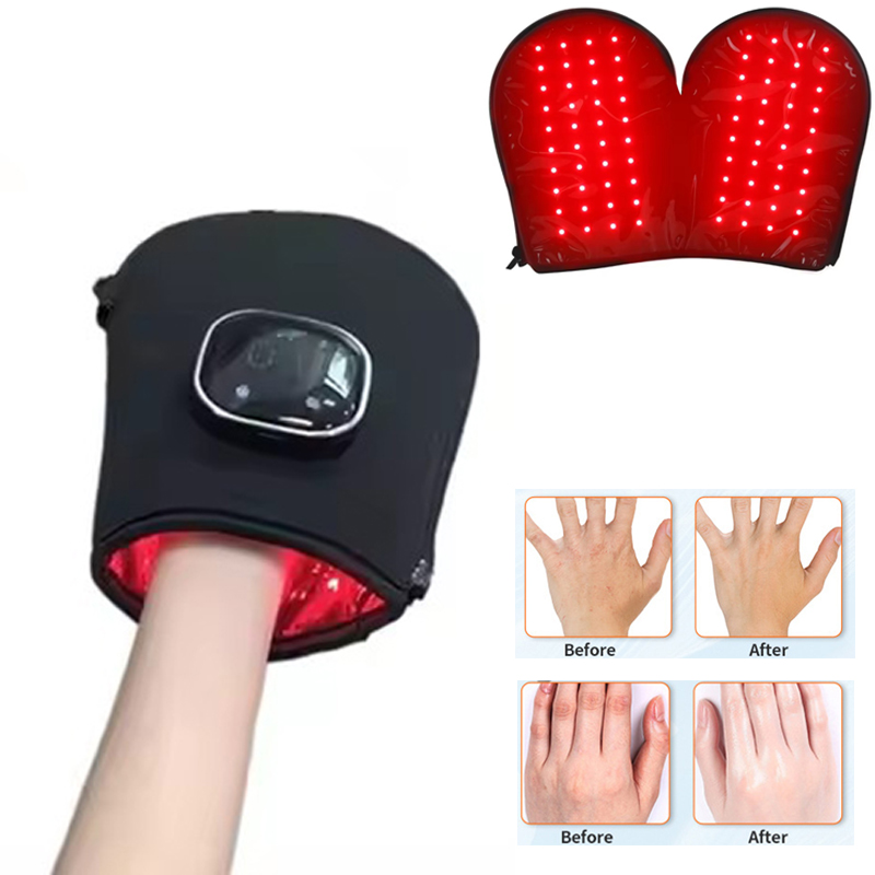 Heated Gloves Electric - 손을 위한 새로운 레드 라이트 테라피